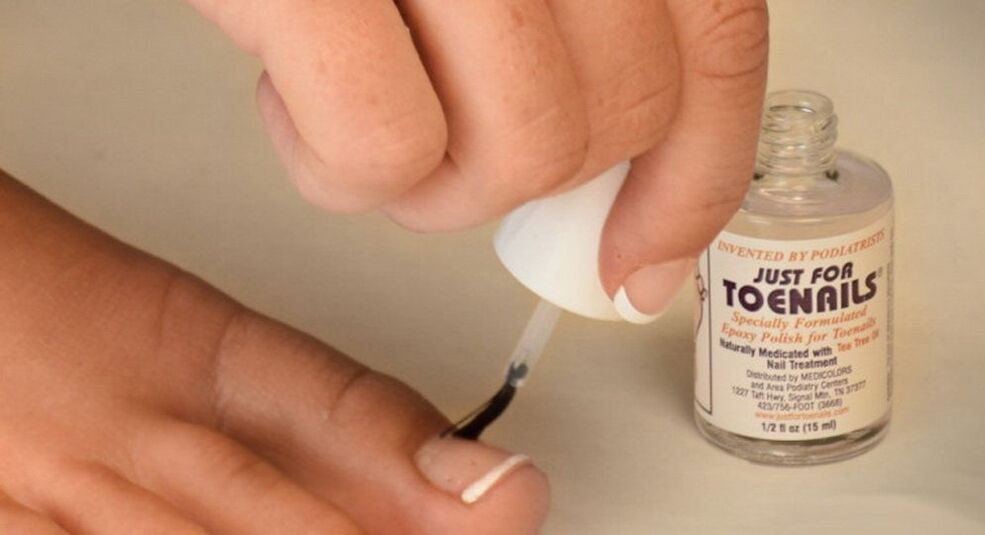Vernis à ongles contre les champignons du gros orteil