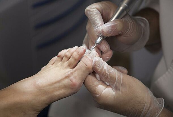 Diagnostic des champignons des jambes