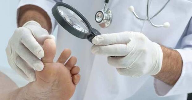 Examen des pieds pour les infections fongiques