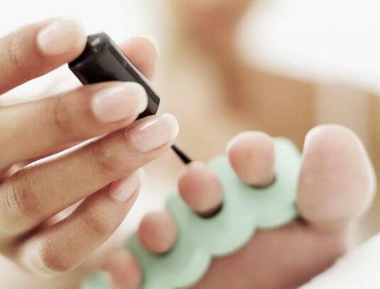 Traiter les ongles avec du vernis à ongles pour une infection fongique