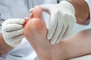 Le médecin examine les pieds à la recherche d'infections fongiques sur les orteils