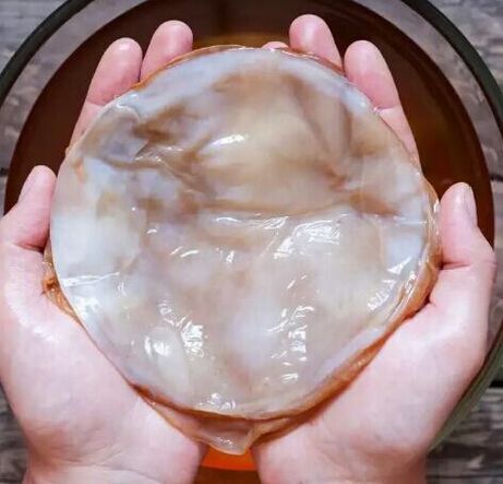 Kombucha contre les champignons des ongles